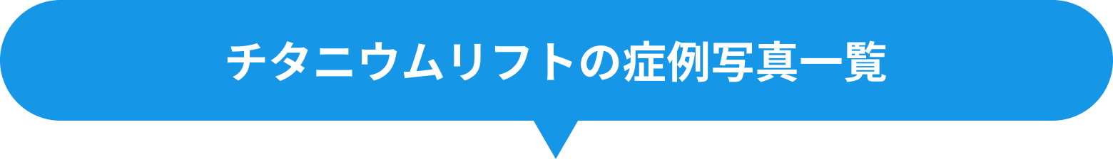 チタニウムリフトの症例写真一覧