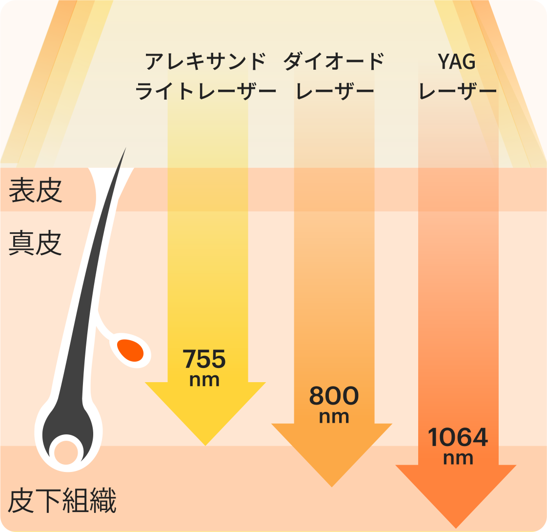 医療脱毛レーザー